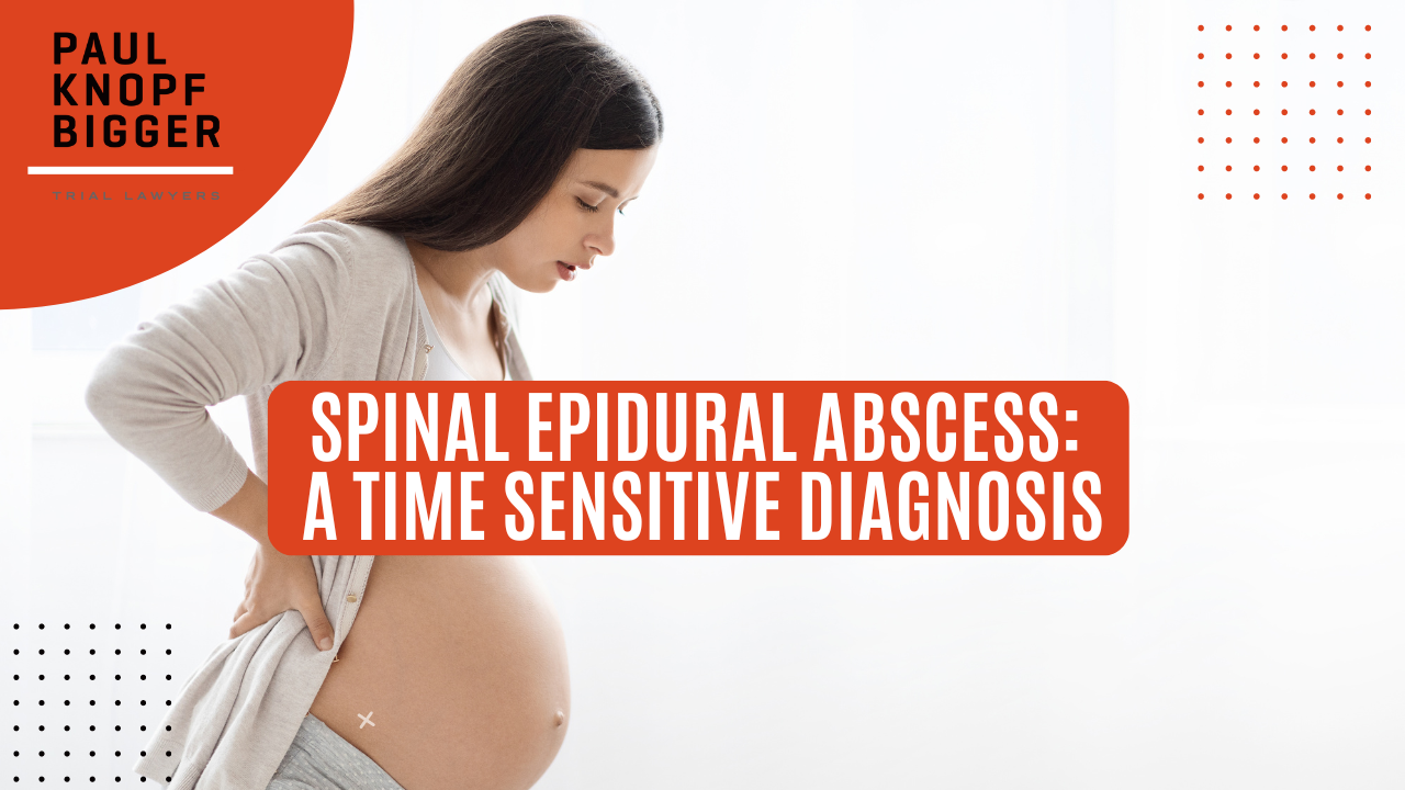 Spinal Epidural Abscess: A Time Sensitive Diagnosis