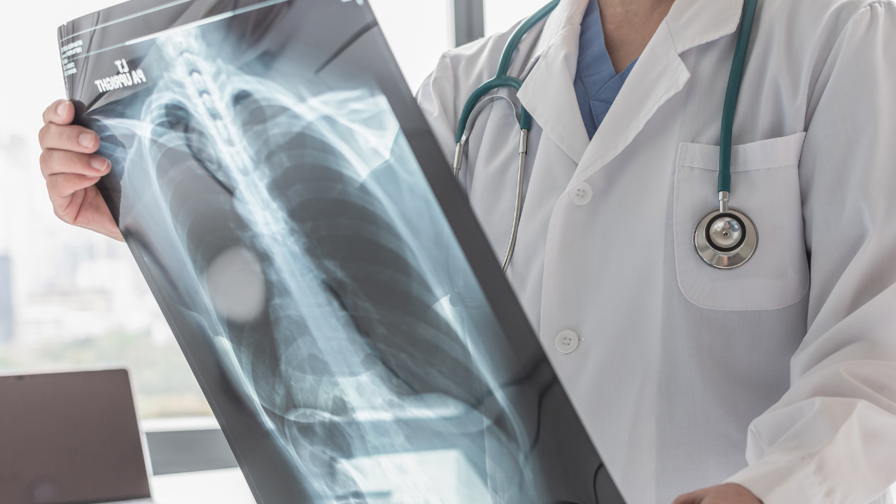 Medical imaging—such as X-rays, MRIs, and CT scans—is crucial for diagnosing a range of illnesses and injuries. Radiologists are highly trained specialists who interpret these images to guide physicians in making accurate diagnoses and treatment plans. Unfortunately, when radiologists make errors, it can lead to a range of medical complications, sometimes causing irreversible damage.