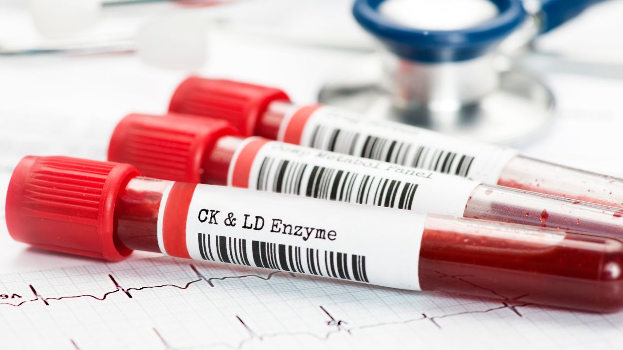 A misdiagnosis occurs when a medical professional fails to identify a condition accurately or provides an incorrect diagnosis. This error can lead to delayed treatment, unnecessary medical procedures, or, worst of all, a worsening of the patient’s condition.